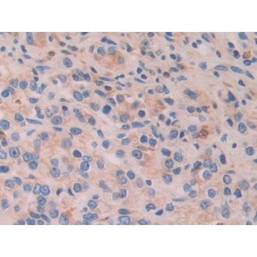 Activating Transcription Factor 4 (ATF4) Human Polyclonal Antibody
