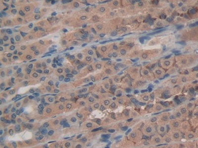 Activating Transcription Factor 4 (ATF4) Rat Polyclonal Antibody