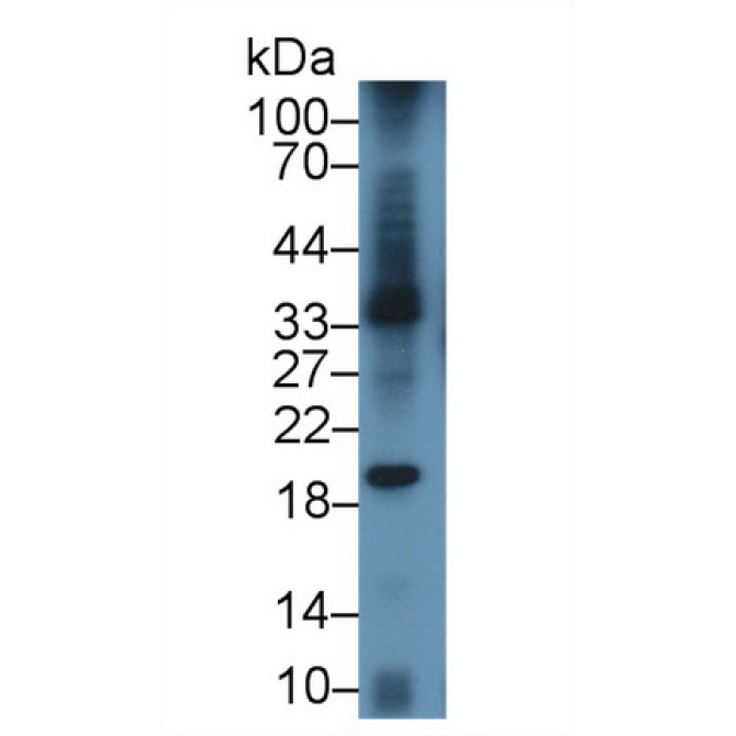 B-Lymphocyte Activation Antigen B7-1 (LAB7-1) Mouse Polyclonal Antibody