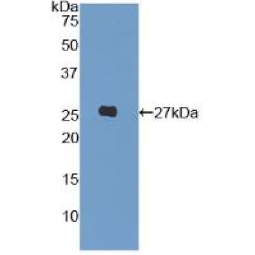 Leukocyte Immunoglobulin Like Receptor Subfamily A, Member 3 (LILRA3) Human Polyclonal Antibody