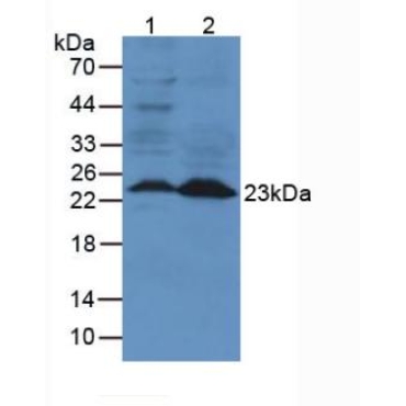 Neutrophil gelatinase-associated lipocalin (NGAL) Mouse Polyclonal Antibody