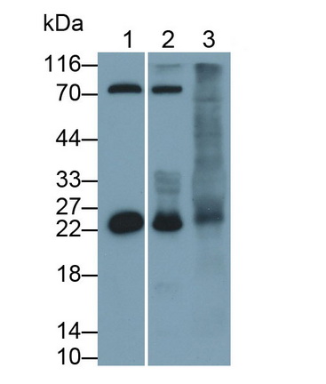 Neutrophil gelatinase-associated lipocalin (NGAL) Rat Polyclonal Antibody
