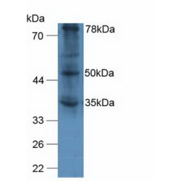 Von Willebrand Factor A Domain Containing Protein 2 (vWA2) Human Polyclonal Antibody