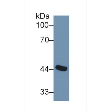 Adenosine Deaminase (ADA) Human Polyclonal Antibody