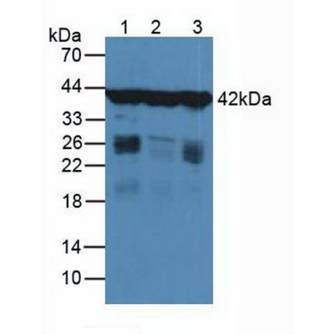 Gamma Actin (ACTG) Human Polyclonal Antibody