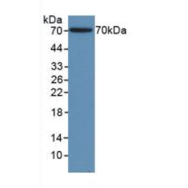 Gamma Actin (ACTG) Human Polyclonal Antibody