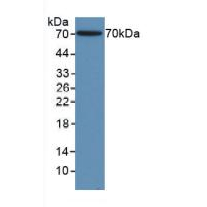 Gamma Actin (ACTG) Human Polyclonal Antibody