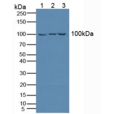 Leukocyte Immunoglobulin Like Receptor Subfamily B, Member 1 (LILRB1) Human Polyclonal Antibody