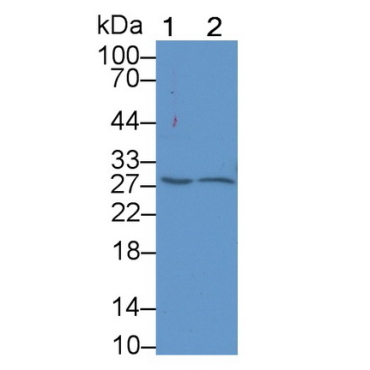 Platelet Activating Factor Acetylhydrolase Ib3 (PAFAH1B3) Human Polyclonal Antibody