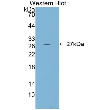 Protocadherin Beta 2 (PCDHb2) Human Polyclonal Antibody