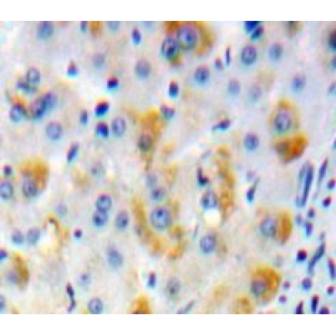 Adenylate Cyclase 2, Brain (ADCY2) Human Polyclonal Antibody