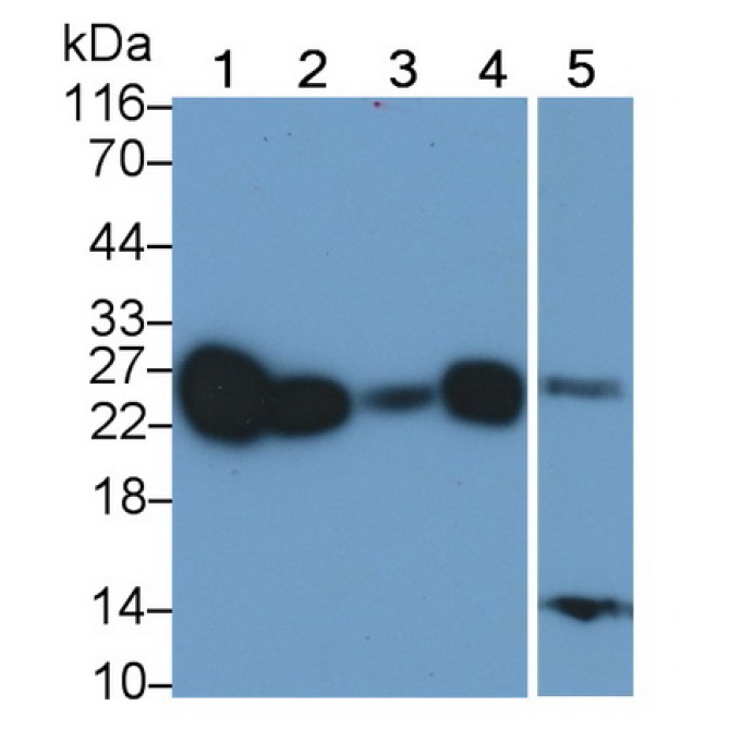 Cluster of Differentiation 90 (CD90) Human Polyclonal Antibody