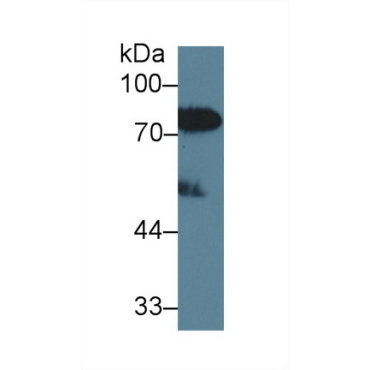 Lipopolysaccharide Binding Protein (LBP) Human Polyclonal Antibody