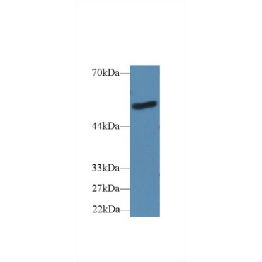 Lipopolysaccharide Binding Protein (LBP) Mouse Polyclonal Antibody