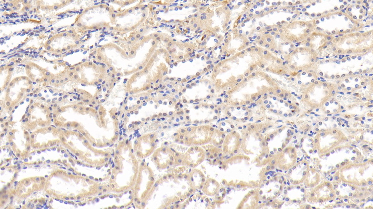 Lipopolysaccharide Binding Protein (LBP) Rabbit Polyclonal Antibody