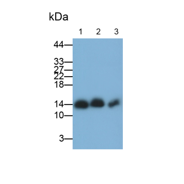 Hemoglobin (HB) Human Polyclonal Antibody