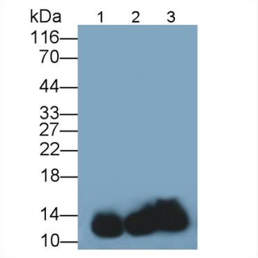 Hemoglobin (HB) Human Polyclonal Antibody