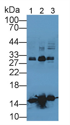 Hemoglobin (HB) Pig Polyclonal Antibody
