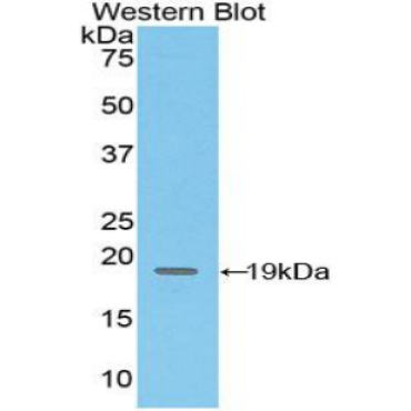 Cluster Of Differentiation 97 (CD97) Mouse Polyclonal Antibody
