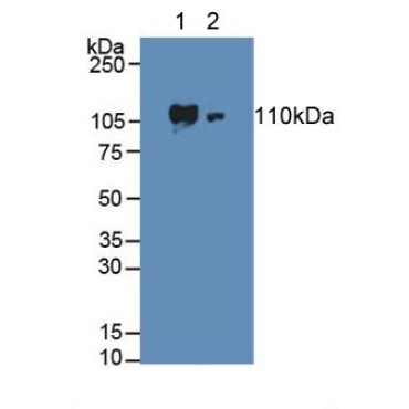 Adenylate Cyclase 3 (ADCY3) Human Polyclonal Antibody