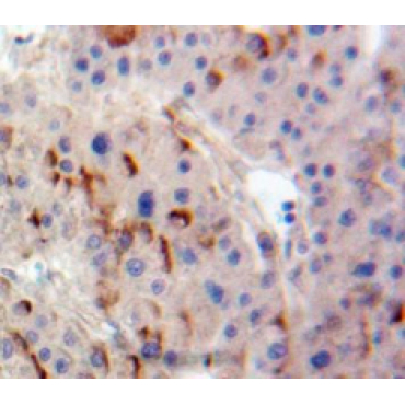 Adenylate Cyclase 4 (ADCY4) Mouse Polyclonal Antibody