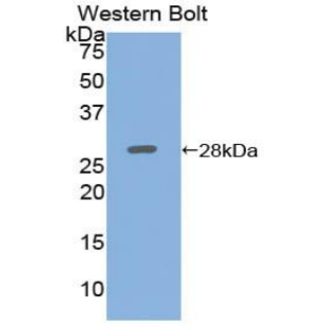 Adenylate Cyclase 5 (ADCY5) Human Polyclonal Antibody
