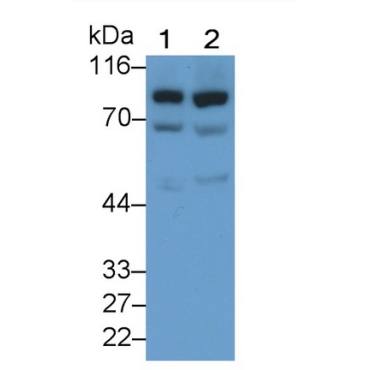 Glucuronidase Beta (GUSb) Human Polyclonal Antibody