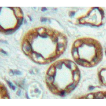 Adenylate Cyclase 6 (ADCY6) Human Polyclonal Antibody