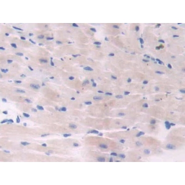 Adenylate Cyclase 6 (ADCY6) Mouse Polyclonal Antibody