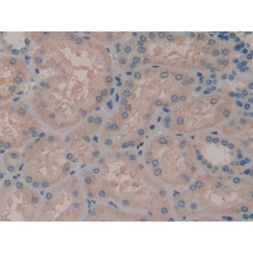 Adenylate Cyclase 7 (ADCY7) Human Polyclonal Antibody