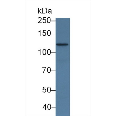 Adenylate Cyclase 7 (ADCY7) Mouse Polyclonal Antibody