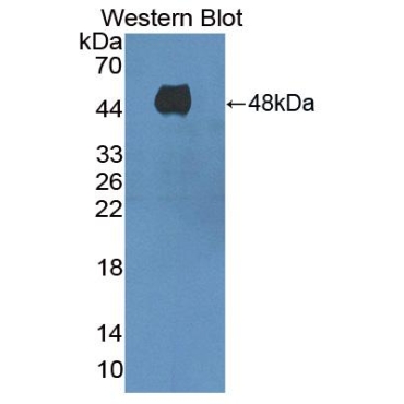 Adenylate Cyclase 8, Brain (ADCY8) Human Polyclonal Antibody