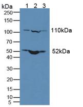 Nuclear Pore Glycoprotein 210 (gp210) Human Polyclonal Antibody