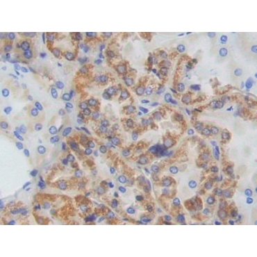 Adenylate Cyclase 9 (ADCY9) Human Polyclonal Antibody