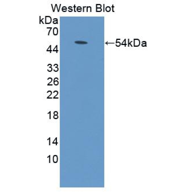 Adenylate Cyclase 9 (ADCY9) Mouse Polyclonal Antibody