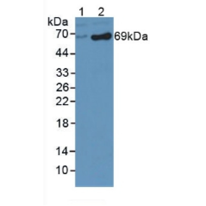 Dopamine Beta Hydroxylase (DbH) Human Polyclonal Antibody