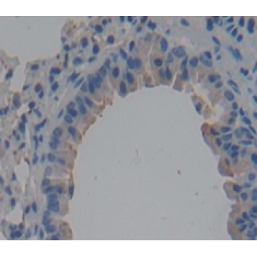Immunoglobulin Superfamily, Member 2 (IGSF2) Mouse Polyclonal Antibody