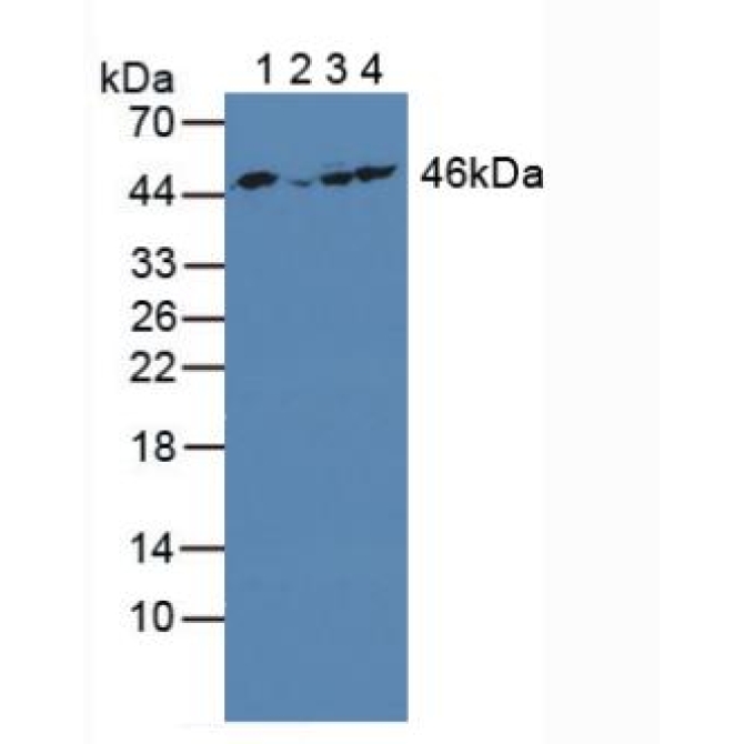 Enolase 3 (ENO3) Human Polyclonal Antibody