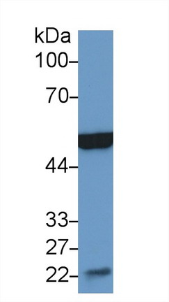 Enolase 3 (ENO3) Mouse Polyclonal Antibody