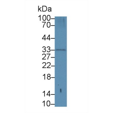 Proteinase 3 (PR3) Human Polyclonal Antibody