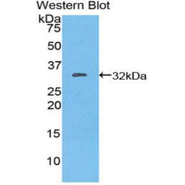 Integrin Alpha E (ITGaE) Mouse Polyclonal Antibody