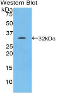 Integrin Alpha E (ITGaE) Mouse Polyclonal Antibody