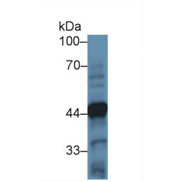 Tyrosine Hydroxylase (TH) Human Polyclonal Antibody