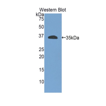 Integrin Beta 4 (ITGb4) Human Polyclonal Antibody
