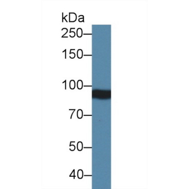 Integrin Beta 4 (ITGb4) Mouse Polyclonal Antibody