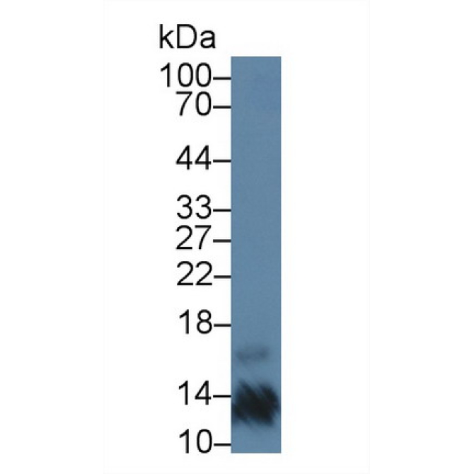 Placental Protein 13 (PP13) Human Polyclonal Antibody