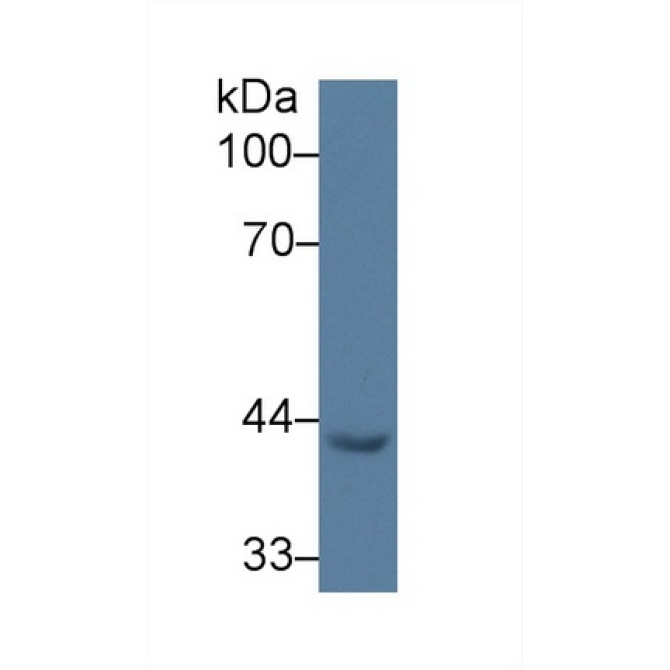 Early Growth Response Protein 3 (EGR3) Human Polyclonal Antibody