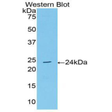 Acetylcholinesterase (ACHE) Human Polyclonal Antibody