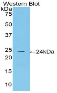 Acetylcholinesterase (ACHE) Human Polyclonal Antibody