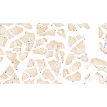 Acetylcholinesterase (ACHE) Mouse Polyclonal Antibody